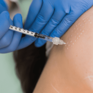 Mesotherapy Teatment