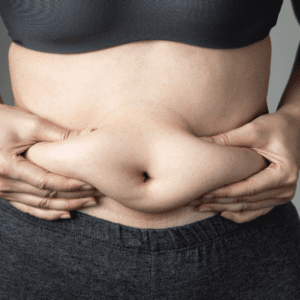Fat Dissolving Injections for Upper & Lower Abdomen