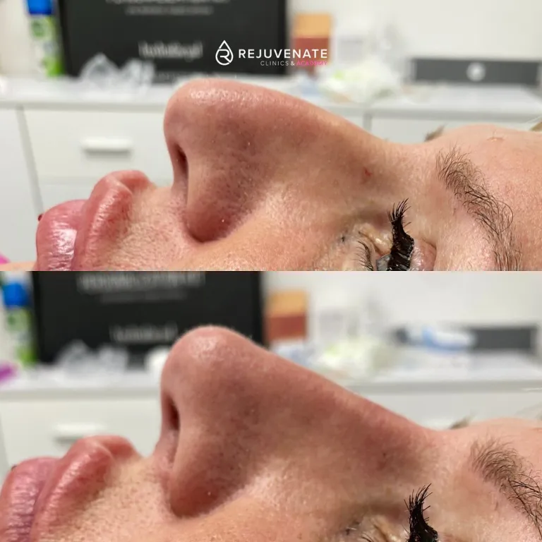 nose5