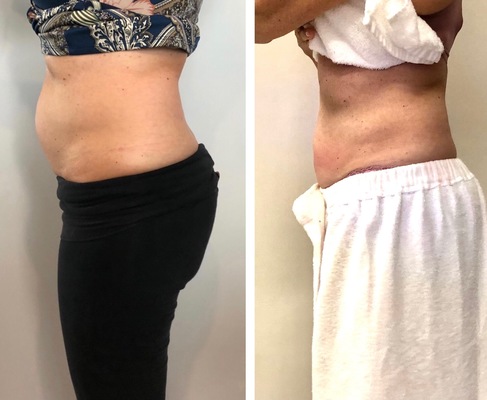 Jessica, 45,East Ham
*After 2 Sessions