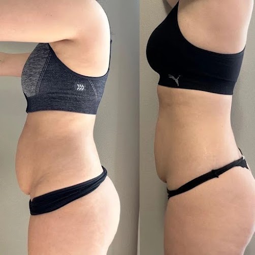 Sophia, 46, Hackney
*After 2 Sessions